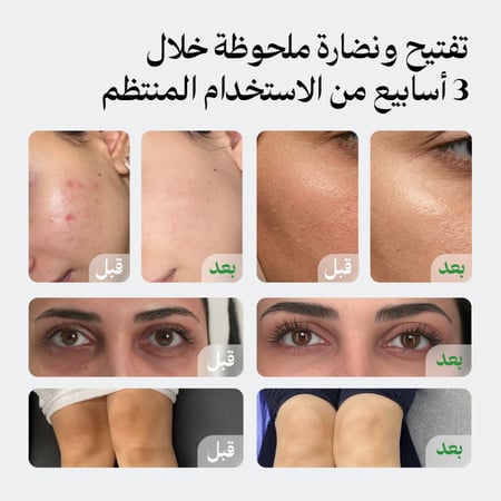 مجموعة لونيل المتكاملة