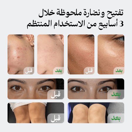 مجموعة لونيل المتكاملة