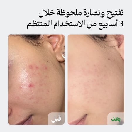 (طلب مسبق) سيروم التفتيح والنضارة