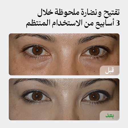 كريم الهالات للتفتيح والنضارة