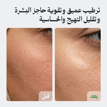 مجموعة الهالات والترطيب