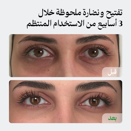 (طلب مسبق) كريم الهالات للتفتيح والنضارة