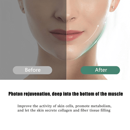 جهاز تنحيف الوجه بالإضاءة