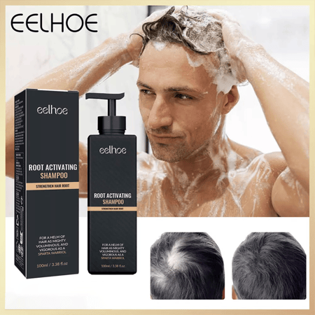 شامبو لتساقط الشعر