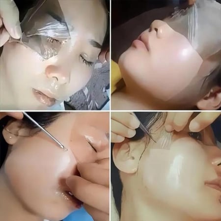 ماسك لازاله النمش