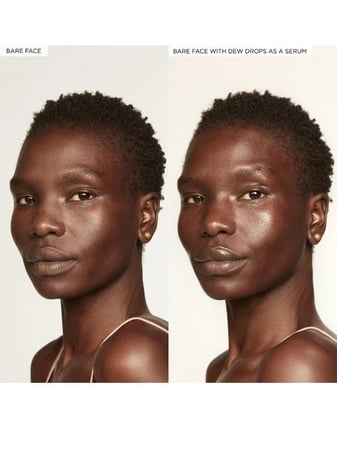 مصل نياسيناميد