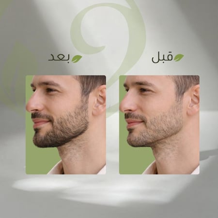 زيت الانبات