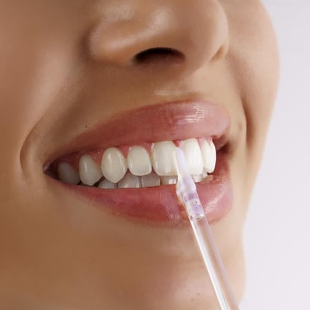 ملمع الأسنان