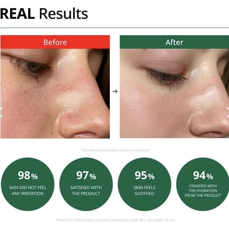 كريم ملطف ومرطب من دكتور جي DR.G R.E.D BLEMISH CLEAR SOOTHING CREAM