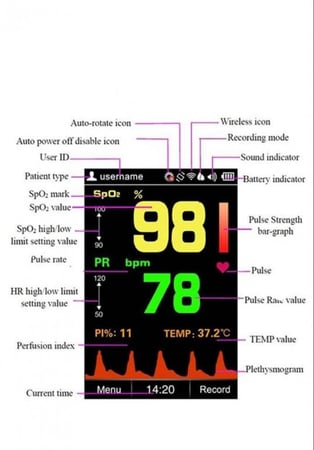 جهاز قياس نسبة  الاوكسيجين في الدم اطفال handheld pulse oximeter sp-