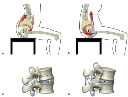 مشد للميل الحوضي الأمامي للكرش و الخفسات