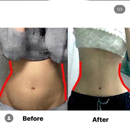 خطة "القلو اب" للتجميل البشرة والوجة بدون عمليات جراحية