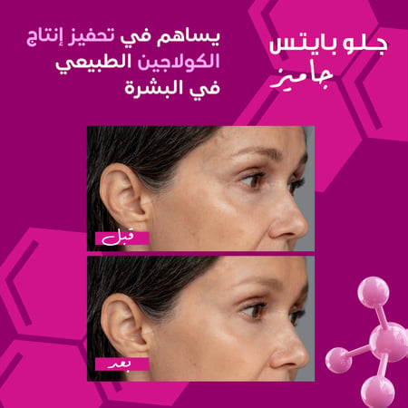 جلو بايتس 60 قطعة حلوى ايلمنت كولاجين -  Glow Bites gummies