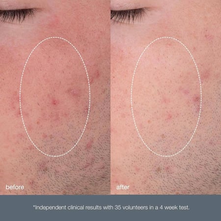 مقشر Dermalogica اليومي الدقيق يقشر وينعم ويفتح البشرة 13 جرام