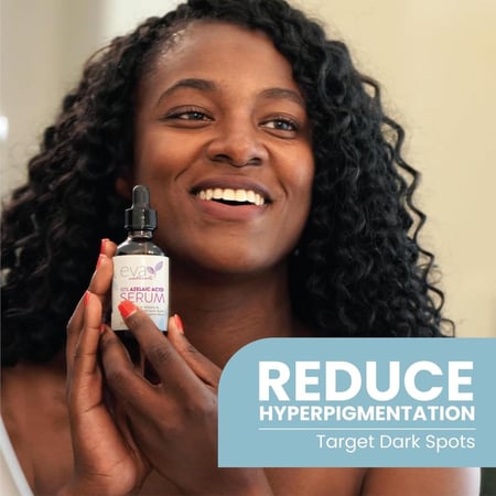 سيروم الوجه بحمض الأزيليك 10بالمية من إيفا ناتشورالز 60 مل