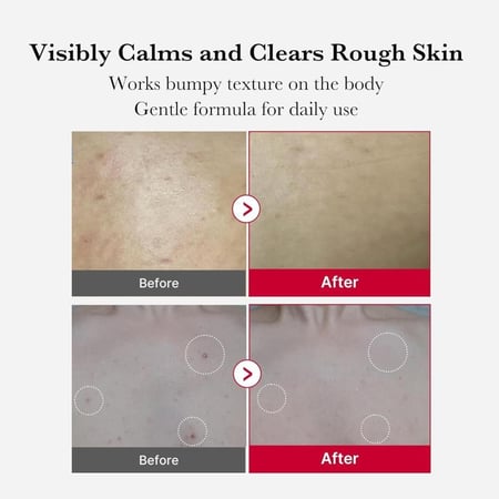 ميديكيوب غسول لتقشير الجسم وعلاج حب الشباب - 110g