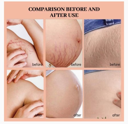 مجموعة تمدد الجلد من يوث دايري - 50 مل