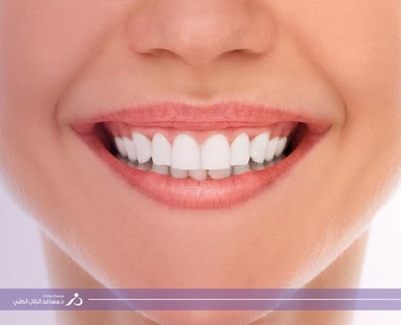 ابتسامة هوليود 16 اسنان يبدأ من