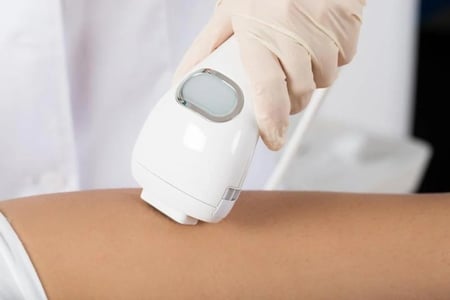 ليزر ثلثين الظهر للنساء