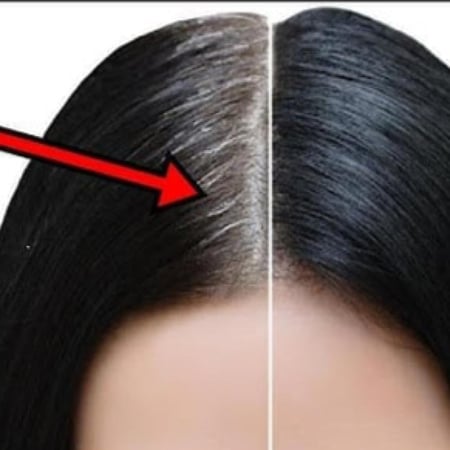 تونيك علاج الشيب وحل جميع مشاكل الشعر