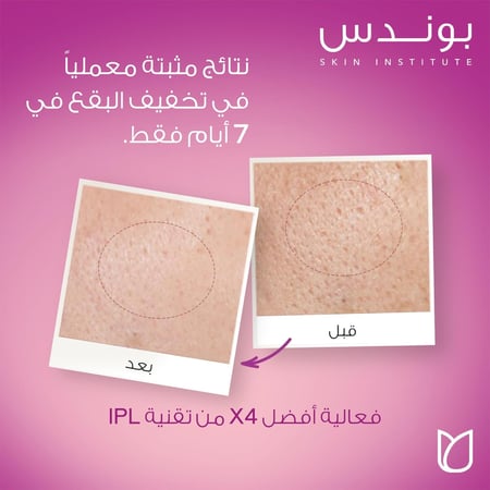 كريم النهار المرطب فلولس راديانس مع عامل حماية SPF 30 من بوندس - 50 مل