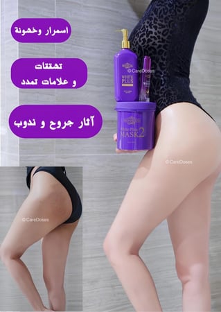 مجموعة التبييض الناصع من مدام ليزا Madame Lisa White Plus Set Whitening Skin