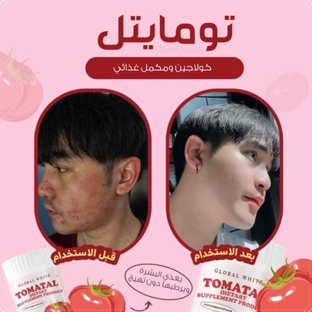كولاجين الطماطم تومايتل قلوبال وايت Tomatal Global White Collagen