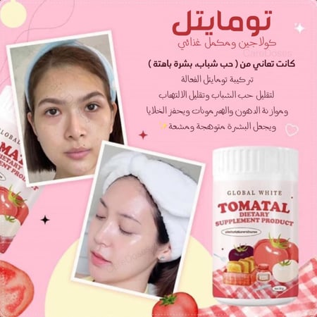 كولاجين الطماطم تومايتل قلوبال وايت Tomatal Global White Collagen