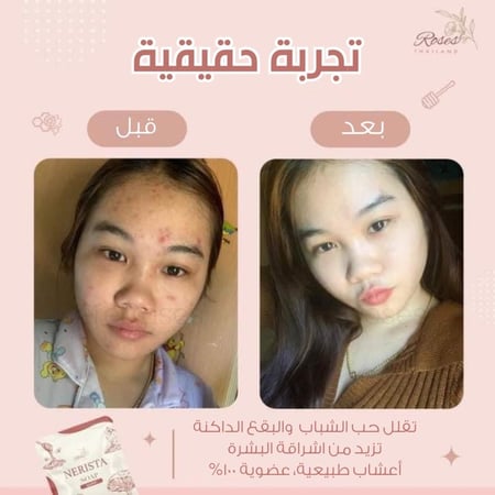 صابونة التفتيح للوجه من نيريستا - Nerista Face Soap