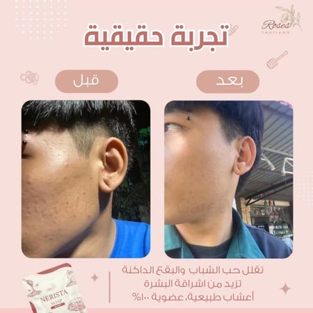 صابونة التفتيح للوجه من نيريستا - Nerista Face Soap