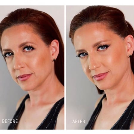 المشبك الخفي لشد الحاجب والوجه  - دبل