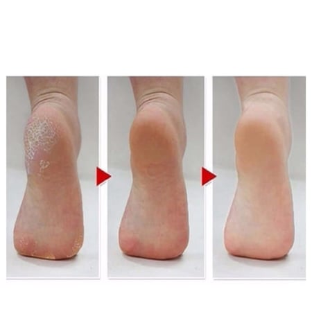 جوارب تقشير القدمين السحرية من ام بيوتي