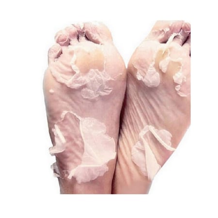 جوارب تقشير القدمين السحرية من ام بيوتي