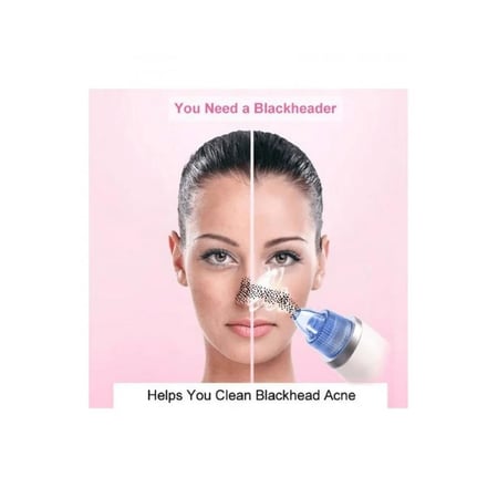 جهاز تنظيف الرؤوس السوداء من اوكيما - OK-457