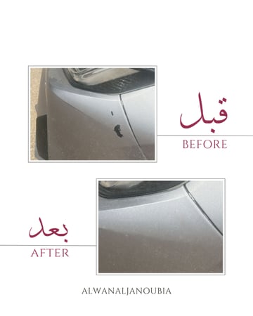 البكج الاحترافي