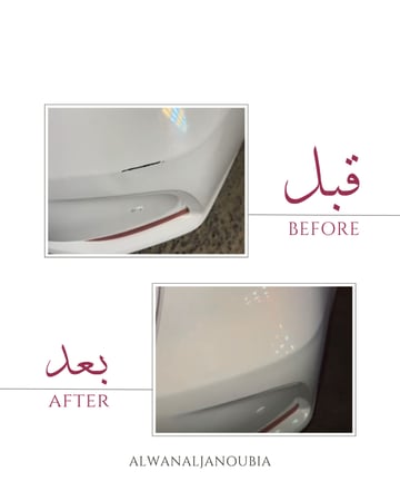 البكج الاحترافي