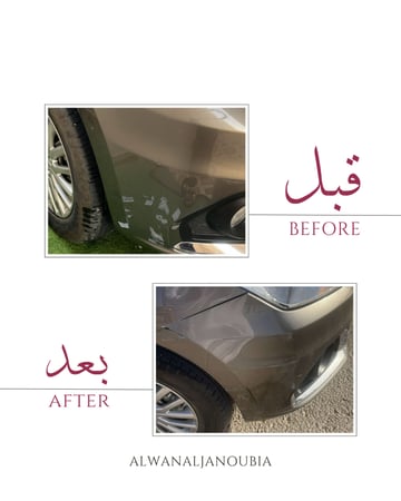 البكج الاحترافي