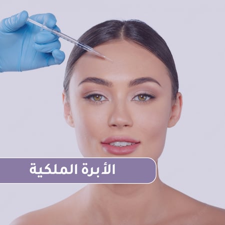 الابرة الملكية