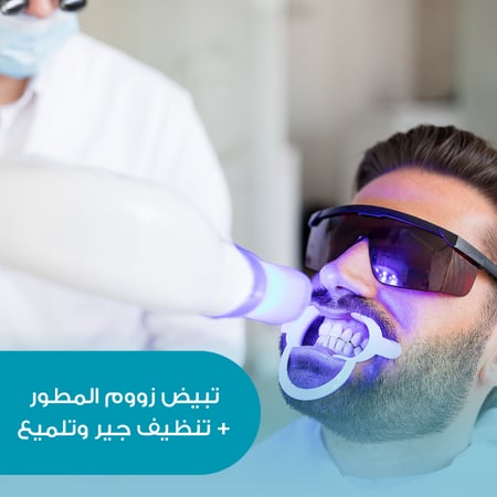 جلسة تبييض أسنان + تنظيف جير وتلميع + استشارة وكشفية مجانية