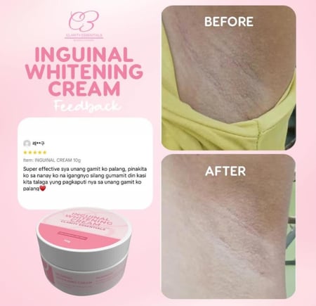 كريم تبيض البكيني و المناطق من كلاريتي