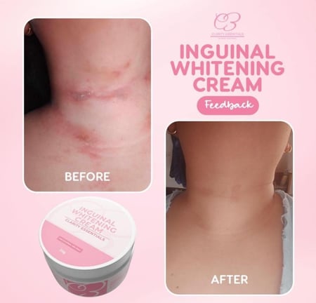 كريم تبيض البكيني و المناطق من كلاريتي