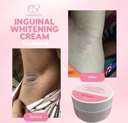 كريم تبيض البكيني و المناطق من كلاريتي