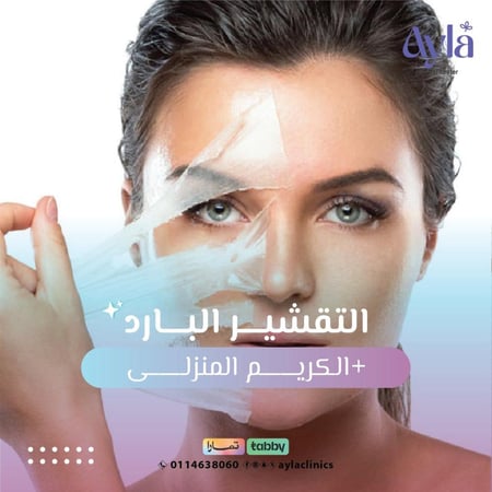 جلسة تقشير بارد اميلان بكريم