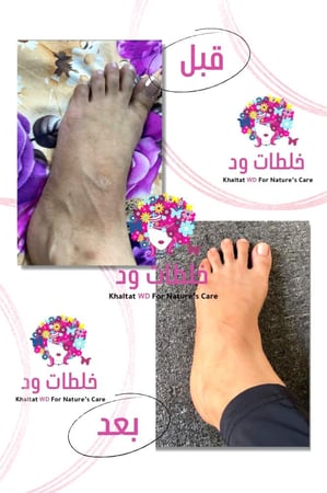 صابونية ود للتفتيح