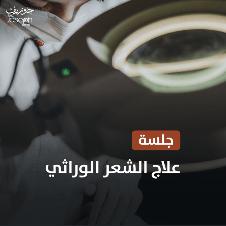 جلسة علاج الشعر الوراثي