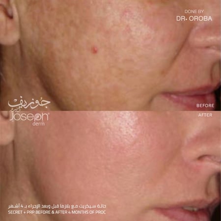 جلسة سيكريت