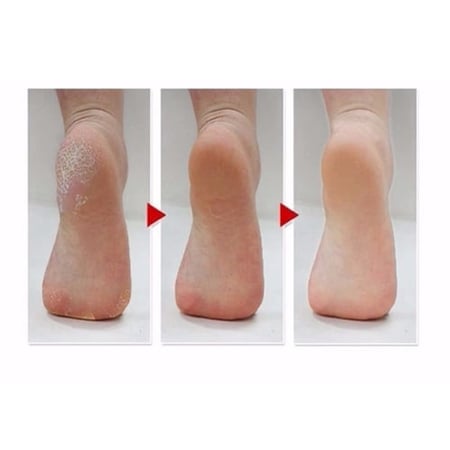جوارب القدم السحرية ام بيوتي لتقشير القدمين mbeauty exfoliating magic foot