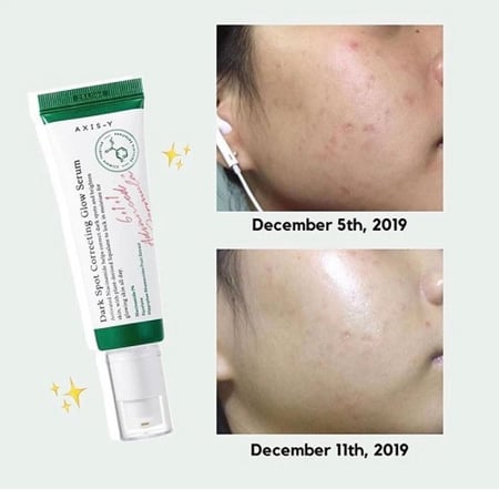 اكسيس واي سيروم تفتيح البقع السوداء 50مل