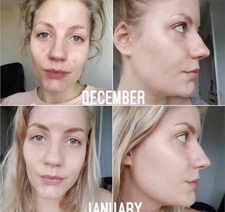 سيروم مكافحة التصبغات ذا اورديناري Niacinamide 10% + Zinc 1% -