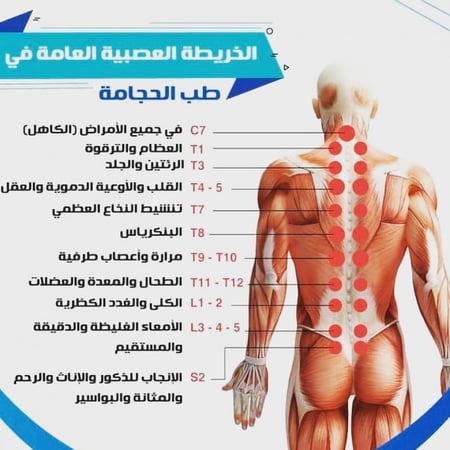 حجامة اصفر AH